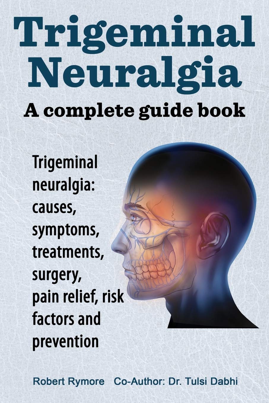 Best Treatment for Neuralgia: Top Solutions for Neuralgia Relief